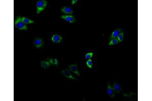 Immunofluorescent analysis of HepG2 cells using ABIN7143307 at dilution of 1:100 and Alexa Fluor 488-congugated AffiniPure Goat Anti-Rabbit IgG(H+L) (Adenosine A2b Receptor Antikörper  (AA 292-332))
