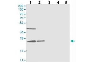 Western blot analysis of Lane 1: RT-4, Lane 2: U-251 MG, Lane 3: Human Plasma, Lane 4: Liver, Lane 5: Tonsil with UQCC polyclonal antibody  at 1:250-1:500 dilution. (Ubiquinol-Cytochrome C Reductase Complex Chaperone (UQCC) Antikörper)