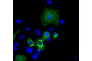 Image no. 1 for anti-Induced Myeloid Leukemia Cell Differentiation Protein Mcl-1 (MCL1) antibody (ABIN1499341) (MCL-1 Antikörper)