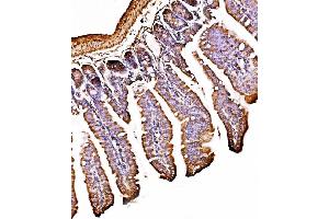 IHC analysis of ORP150/HYOU1 using anti-ORP150/HYOU1 antibody (ABIN7601807).