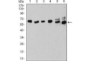 Western blot analysis using ESR1 mouse mAb against MOLT4 (1), Raji (2), MCF-7 (3), T47D (4), SK-Br-3 (5), and Hela (6) cell lysate. (Estrogen Receptor alpha Antikörper  (AA 2-185))