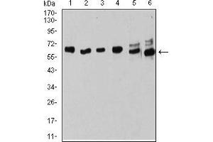 Western blot analysis using ESR1 mouse mAb against MOLT4 (1), Raji (2), MCF-7 (3), T47D (4), SK-Br-3 (5), and Hela (6) cell lysate. (Estrogen Receptor alpha Antikörper  (AA 2-185))