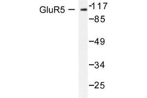 Image no. 1 for anti-Glutamate Receptor, Ionotropic, Kainate 1 (GRIK1) antibody (ABIN265438) (GRIK1 Antikörper)