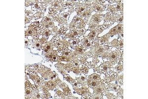 Immunohistochemistry of paraffin-embedded rat liver using ERK5 Rabbit pAb (ABIN3022944, ABIN3022945, ABIN3022946 and ABIN6219309) at dilution of 1:50 (40x lens). (MAPK7 Antikörper  (AA 1-310))