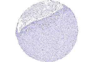 Liver showing a lack of 53BP1 staining in hepatocytes (Rekombinanter TP53BP1 Antikörper  (C-Term))