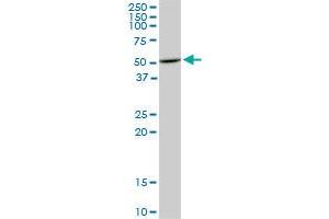 HDAC3 monoclonal antibody (M02), clone 3E11. (HDAC3 Antikörper  (AA 319-428))