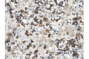 Hemoglobin Zeta antibody was used for immunohistochemistry at a concentration of 4-8 ug/ml to stain Hemopoietic cells (arrows) in Human Liver. (HBZ Antikörper  (N-Term))