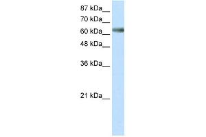 WB Suggested Anti-ZNF447 Antibody Titration: 0. (ZSCAN18 Antikörper  (Middle Region))