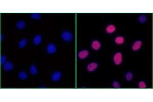 Immunofluorescence (IF) image for anti-Replication Protein A2, 32kDa (RPA2) (pSer4), (pSer8) antibody (ABIN7453379) (Rekombinanter RPA2 Antikörper  (pSer4, pSer8))