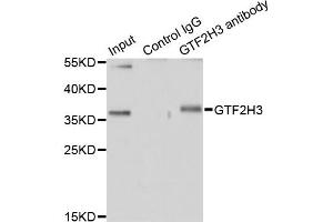 Immunoprecipitation analysis of 200 μg extracts of HT-29 cells using 1 μg GTF2H3 antibody (ABIN5974322). (GTF2H3 Antikörper)