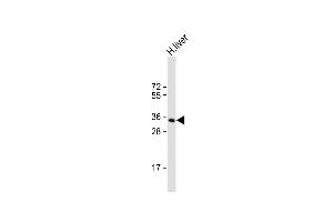 Anti-GNMT Antibody (Center) at 1:1000 dilution + human liver lysate Lysates/proteins at 20 μg per lane. (GNMT Antikörper  (AA 78-106))