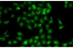 Immunofluorescence analysis of MCF7 cells using MBNL1 Polyclonal Antibody (MBNL1 Antikörper)