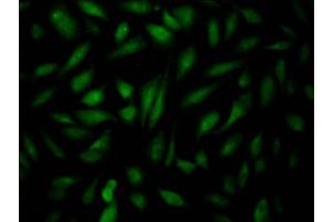 Immunofluorescence staining of Hela Cells with ABIN7127543 at 1:50, counter-stained with DAPI. (Rekombinanter EPAS1 Antikörper)
