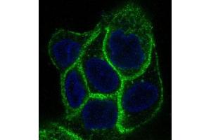 Immunofluorescent analysis of A431 cells, using EGFR Antibody . (Rekombinanter EGFR Antikörper)