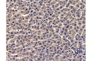 ABIN7095055 and ABIN7099111 at 1/100 staining rat heart tissue by IHC-P.