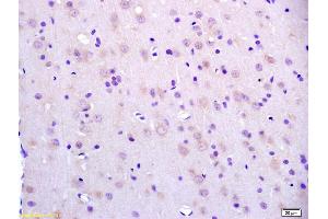 Formalin-fixed and paraffin embedded rat brain labeled with Anti-BCAT2/BCAM Polyclonal Antibody, Unconjugated (ABIN718511) at 1:200 followed by conjugation to the secondary antibody and DAB staining.