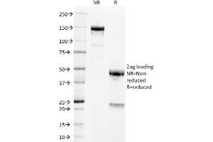 SDS-PAGE Analysis Purified PLAP Mouse Monoclonal Antibody (GM022). (PLAP Antikörper)