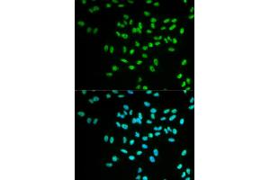 Immunofluorescence analysis of MCF-7 cells using FANCD2 antibody. (FANCD2 Antikörper)