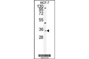 Western blot analysis of TTPAL Antibody in MCF-7cell line lysates (35ug/lane)