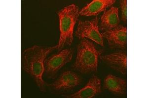 IF analysis of BRCA1 using anti-BRCA1 antibody (ABIN5518742) and anti-Beta Tubulin antibody (ABIN7602743).