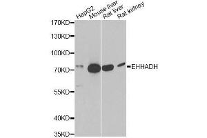 Western blot analysis of extracts of various cell lines, using EHHADH antibody. (EHHADH Antikörper  (AA 444-723))