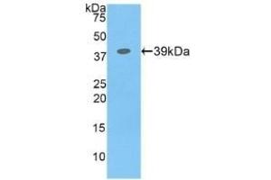 Detection of Recombinant CSF2Rb, Human using Polyclonal Antibody to Colony Stimulating Factor 2 Receptor Beta (CSF2Rb) (CD131 Antikörper  (AA 133-233))