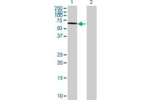 Western Blot analysis of SCARB2 expression in transfected 293T cell line by SCARB2 MaxPab polyclonal antibody. (SCARB2 Antikörper  (AA 1-478))