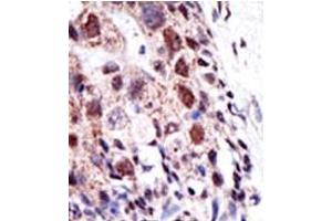 Image no. 2 for anti-Ubiquitin-Conjugating Enzyme E2S (UBE2S) (N-Term) antibody (ABIN357497)