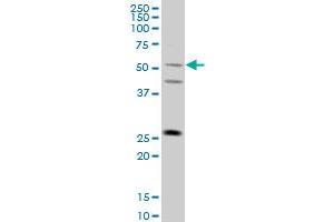 FLJ36180 monoclonal antibody (M01), clone 4F8 Western Blot analysis of FLJ36180 expression in A-431 . (TRIML1 Antikörper  (AA 369-468))