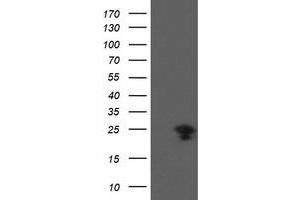 Western Blotting (WB) image for anti-Prefoldin Subunit 3 (PFDN3) antibody (ABIN1501702)