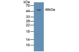 Detection of LOX1 in Mouse Liver Tissue using Polyclonal Antibody to Lectin Like Oxidized Low Density Lipoprotein Receptor 1 (LOX1) (OLR1 Antikörper  (AA 51-314))
