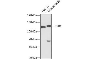 Western blot analysis of extracts of various cell lines, using TSR1 antibody (ABIN6132976, ABIN6149654, ABIN6149655 and ABIN6220781) at 1:3000 dilution. (TSR1 Antikörper  (AA 455-804))