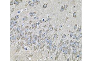 Immunohistochemistry of paraffin-embedded Mouse brain using PRKAB2 Polyclonal Antibody at dilution of 1:100 (40x lens). (PRKAB2 Antikörper)