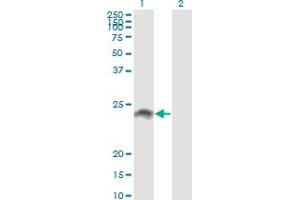 Western Blot analysis of WISP2 expression in transfected 293T cell line by WISP2 monoclonal antibody (M09), clone 3D10. (WISP2 Antikörper  (AA 24-250))