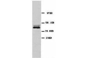 Image no. 1 for anti-Enolase 2 (Gamma, Neuronal) (ENO2) (C-Term) antibody (ABIN1493043) (ENO2/NSE Antikörper  (C-Term))