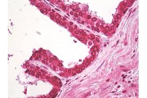 Image no. 1 for anti-ArfGAP with Coiled-Coil, Ankyrin Repeat and PH Domains 2 (ACAP2) (AA 350-400) antibody (ABIN960069)