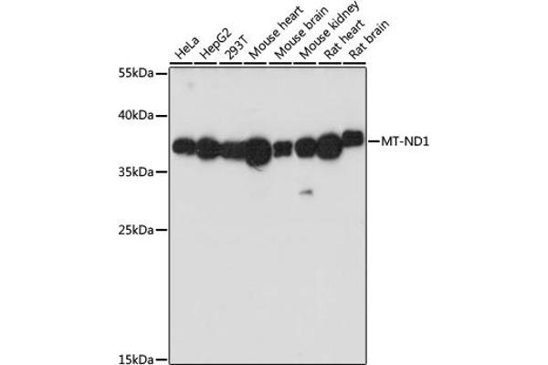 MT-ND1 Antikörper