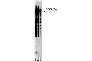 Western blot analysis of phosphotyrosine on A431 cell lysate. (Phosphotyrosine Antikörper)