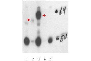 Image no. 1 for anti-Thyroid Hormone Receptor, beta (THRB) (Isoform 1), (Isoform beta-1), (N-Term) antibody (ABIN401449) (THRB Antikörper  (Isoform 1, Isoform beta-1, N-Term))