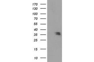 Western Blotting (WB) image for anti-Nudix (Nucleoside Diphosphate Linked Moiety X)-Type Motif 6 (NUDT6) antibody (ABIN1499873) (NUDT6 Antikörper)