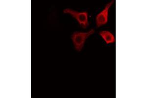 ABIN6267595 staining HuvEc cells by IF/ICC. (Caveolin-1 Antikörper  (pTyr14))