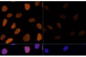 Immunofluorescence analysis of U-2 OS cells using Acetyl-Histone H3-K9/K14/K18/K23/K27 Polyclonal Antibody at dilution of 1:100. (Histone 3 Antikörper  (acLys9, acLys14, acLys18, acLys23, acLys27))