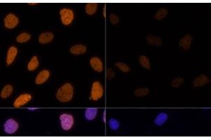 Immunofluorescence (IF) image for anti-Histone H3 (H3) (acLys14), (acLys18), (acLys23), (acLys27), (acLys9) antibody (ABIN7259751)