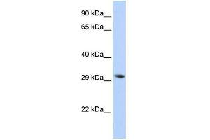 Image no. 1 for anti-Lysophospholipase II (LYPLA2) (N-Term) antibody (ABIN632189) (LYPLA2 Antikörper  (N-Term))