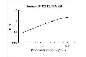 Stanniocalcin 2 (STC2) ELISA Kit