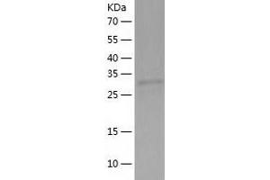 RPRD1B Protein (AA 1-326) (His tag)