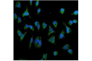 IF analysis of IL2 Receptor beta/p75/IL2RB using anti- IL2 Receptor beta/p75/IL2RB antibody (ABIN7600988). (IL2 Receptor beta Antikörper  (AA 268-551))
