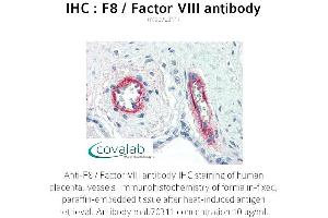Image no. 2 for anti-Coagulation Factor VIII (F8) antibody (ABIN1723234) (Factor VIII Antikörper)