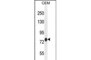 MCAF2 Antibody (Center) (ABIN654466 and ABIN2844199) western blot analysis in CEM cell line lysates (35 μg/lane). (ATF7IP2 Antikörper  (AA 318-347))