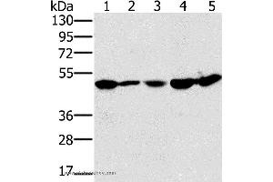 Western blot analysis of 231 and Jurkat cell, mouse liver tissue, 293T and hela cell, using PSMC2 Polyclonal Antibody at dilution of 1:400 (PSMC2 Antikörper)